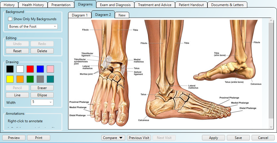 Practice Master Pro - Podiatry Software diagram of female foot 