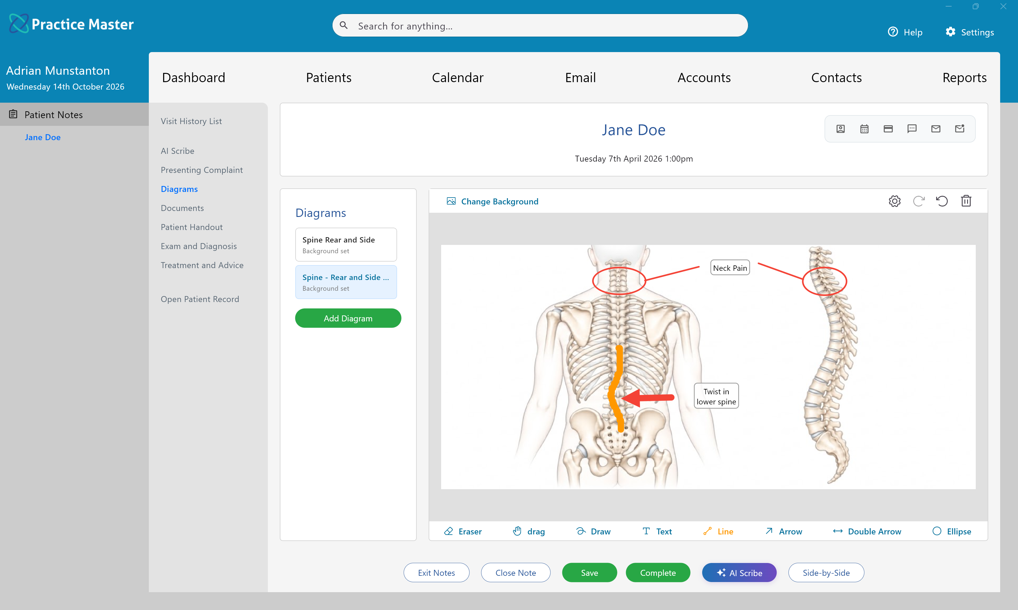 Annotated anatomical diagram within Practice Master Pro patient notes
